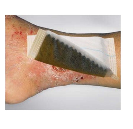 MEDICAZIONE IN TESSUTO NON TESSUTO AL CARBONE ATTIVO E ARGENTO COMPRESSA ASSORBENTE 10X10CM 10 PEZZI - Farma Nice